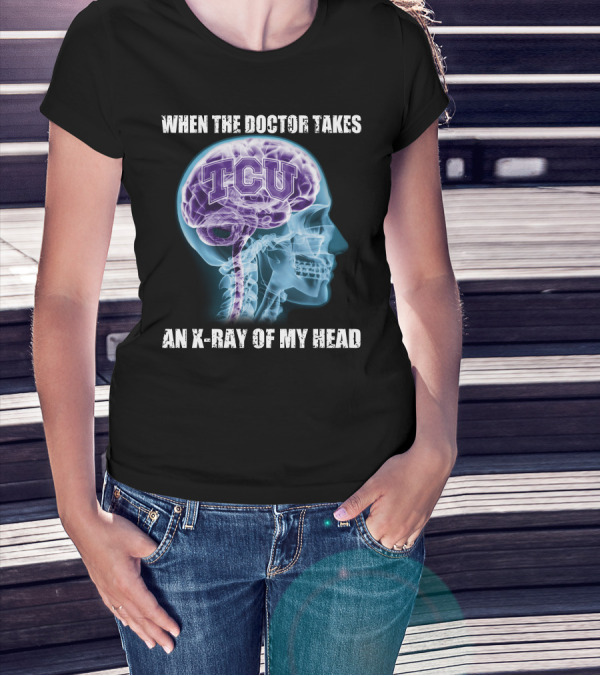 TCU Horned Frogs When The Doctor Takes An X-ray Of My Head T-Shirt