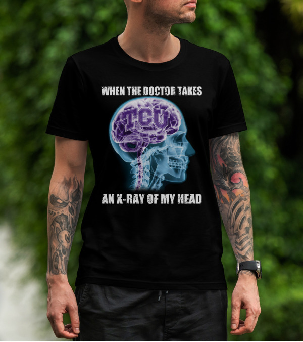 TCU Horned Frogs When The Doctor Takes An X-ray Of My Head T-Shirt
