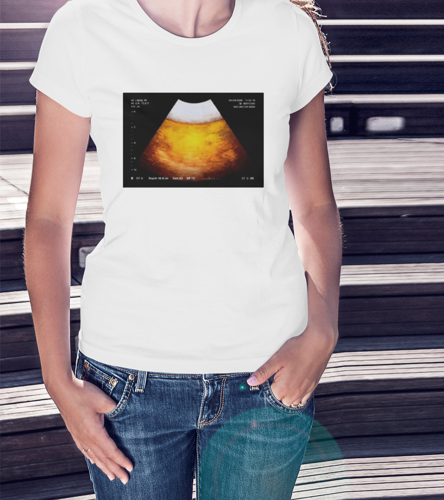Beer Ultrasound Image Not Safe For Liver T-Shirt