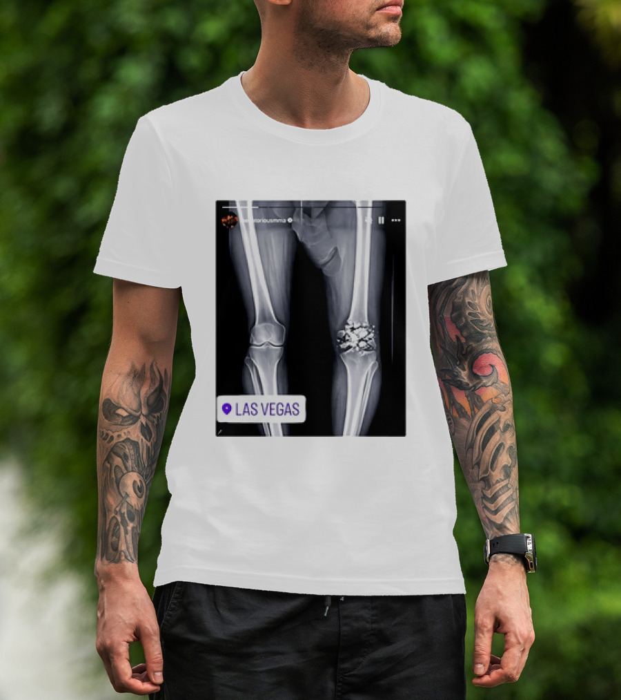 Conor McGregor X Ray Broken Knee Las Vegas T-Shirt